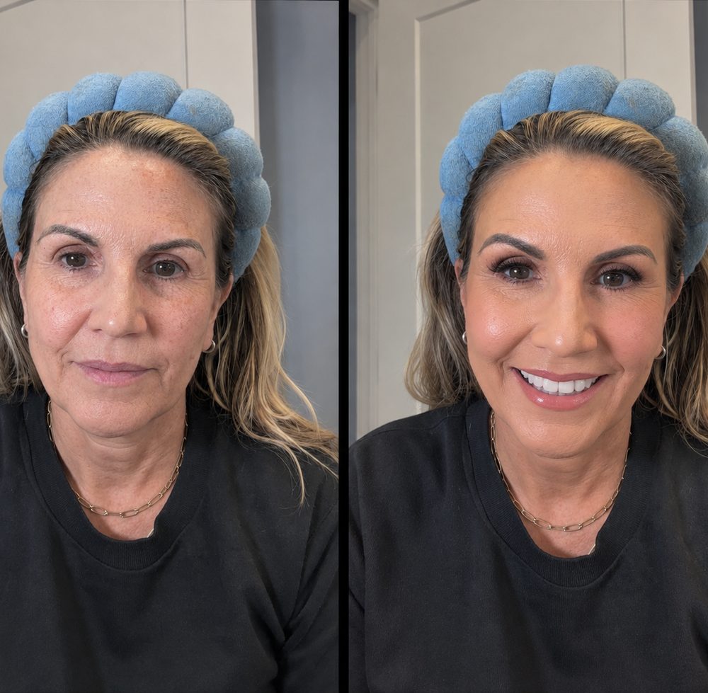 Antes y despues